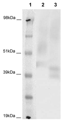 Eurofins Discoverx PathHunter CHO-K1 P2RY8 β-Arrestin Orphan GPCR Cell