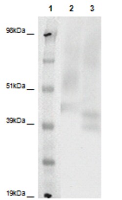 Eurofins Discoverx PathHunter eXpress P2RY8 CHO-K1 β-Arrestin Orphan GPCR