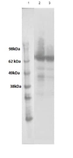 Eurofins Discoverx&nbsp;PathHunter eXpress GPR50 CHO-K1 β-Arrestin Orphan GPCR Assay, 2-Plate Kit. (93-0648E2CP1M)