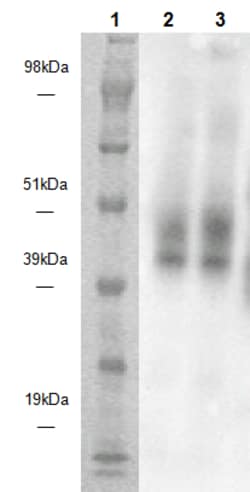 Eurofins Discoverx&nbsp;PathHunter CHO-K1 GPR15 β-Arrestin Orphan GPCR Cell Line, 2 vials. (93-0682C2)
