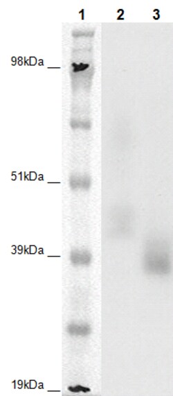 Eurofins Discoverx&nbsp;PathHunter eXpress OXGR1 CHO-K1 β-Arrestin Orphan GPCR Assay, 2-Plate Kit. (93-0693E2CP1M)