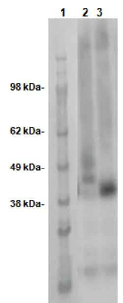 Eurofins Discoverx&nbsp;PathHunter eXpress OPN5 CHO-K1 β-Arrestin Orphan GPCR Assay, 2-Plate Kit. (93-0704E2CP1M)