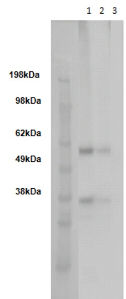 Eurofins Discoverx&nbsp;PathHunter CHO-K1 GPR161 β-Arrestin Orphan GPCR Cell Line, 2 vials. (93-0705C2)