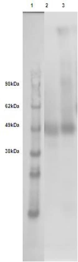 Eurofins Discoverx&nbsp;PathHunter CHO-K1 GPR182 β-Arrestin Orphan GPCR Cell Line, 2 vials. (93-0754C2)