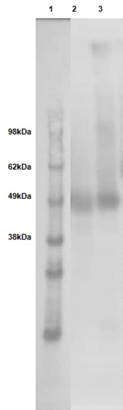 Eurofins Discoverx&nbsp;PathHunter eXpress GPR182 CHO-K1 β-Arrestin Orphan GPCR Assay, 10-Plate Kit. (93-0754E2CP1L)