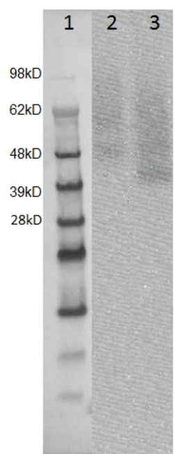 Eurofins Discoverx&nbsp;PathHunter U2OS GPR22 β-Arrestin Orphan GPCR Cell Line, 2 vials. (93-1085C3)
