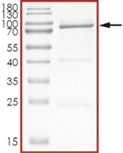 Sino Biological&nbsp;Recombinant Human AKT1 Protein (Full Length, E17K, GST Tag)