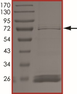 Sino Biological&nbsp;Recombinant Human ATM Protein (GST Tag)