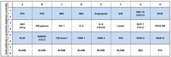 Raybiotech Inc C-Series Human Angiogenesis Antibody Array 1 Kit., Quantity: