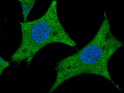 Sino Biological AARSD1 Antibody, Rabbit MAb 100µL, Quantity: Each of 1