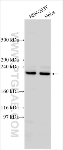 ABCC10 Rabbit, anti-Human, Polyclonal, Proteintech Quantity: 20 &mu;L:Antibodies