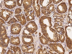 Sino Biological Anti-ABCF2 Antibody, Rabbit Polyclonal, Quantity: Each