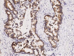 Sino Biological Anti-ABHD1 Antibody, Rabbit Polyclonal, Quantity: Each