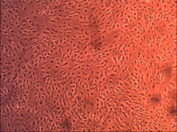 Cell Systems Corporation PRIMARY HUMAN BRAIN PERICYTES