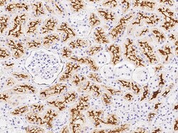 Sino Biological Anti-ACE2 Antibody, Rabbit Polyclonal, Quantity: Each of