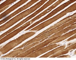 Sino Biological ACO2 / Aconitase 2 Antibody, Rabbit PAb, Antigen Affinity