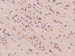 Sino Biological ACOT1 Antibody, Rabbit PAb, Antigen Affinity Purified 100µL,