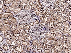 Sino Biological ACOX1 / AOX Antibody, Rabbit MAb 100µL, Quantity: Each