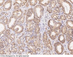 Sino Biological Anti-ACP6 Antibody, Rabbit Polyclonal, Quantity: Each of