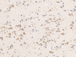 Sino Biological ACSL4 Antibody, Rabbit PAb, Antigen Affinity Purified 100uL,