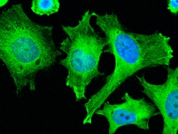 Sino Biological ADSL / Adenylosuccinate Lyase Antibody, Rabbit MAb 100µL,