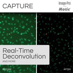 Motic Clinical (Fluorescence) Package: AE31E Trino Inverted Microscope
