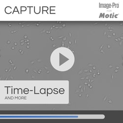 Motic General Bio Package: AE31E Trino Inverted Microscope w/ Moticam S6