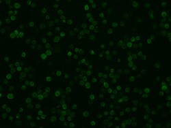 Sino Biological IBA1 / AIF1 Antibody, Rabbit MAb 100uL, Quantity: Each