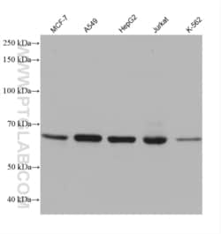 ALAS1 Mouse, anti-Human, Clone: 1B1E4, Proteintech Quantity: 150 &mu;L:Antibodies