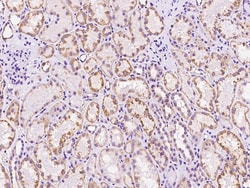 Sino Biological ALDH2 Antibody, Rabbit PAb, Antigen Affinity Purified 100µL,