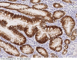 Sino Biological ALDH3A1 Antibody, Rabbit PAb, Antigen Affinity Purified