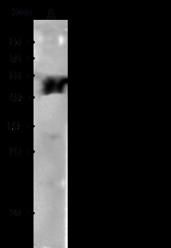 Sino Biological ALDH3A1 Antibody, Rabbit MAb 100uL, Quantity: Each of 1