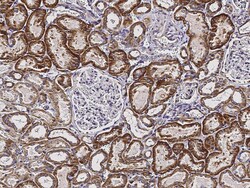 Sino Biological Anti-ACVR1 Antibody, Rabbit Polyclonal, Quantity: Each