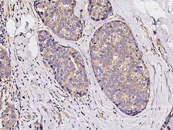 Sino Biological Anti-BMPR1A/ALK-3 Antibody, Rabbit Polyclonal, Quantity: