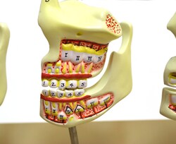 Eisco Model Dentition Development Set 17.7 x 7.9 x 7.9 in. (45 x 20 x 20 cm) | Buy Online | Eisco&trade; | Fisher Scientific