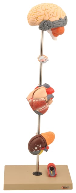 Eisco™ Pathology Model, Hypertension