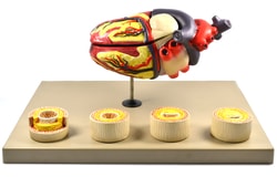 Eisco™ Model of Human Heart Conditions