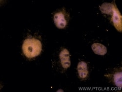 ANKRD1 Mouse, anti-Human, CoraLite Plus 555, Clone: 1F11F1, Proteintech 20 &mu;L | Buy Online | Proteintech | Fisher Scientific