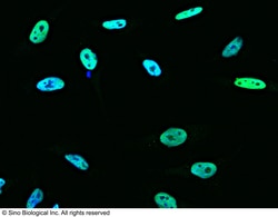 Sino Biological ANP32A / PHAP1 Antibody, Rabbit PAb, Antigen Affinity Purified