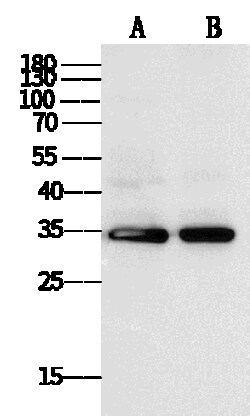 Sino Biological&nbsp;Anti-Annexin V/ANXA5 Antibody, Mouse Monoclonal 100 µL