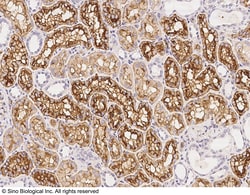 Sino Biological Anti-Aquaporin 1 Antibody, Rabbit Polyclonal, Quantity: