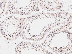 Sino Biological Anti-ARHGAP28 Antibody, Rabbit Polyclonal, Quantity: Each