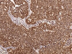 Sino Biological Anti-ARID3A Antibody, Rabbit Polyclonal, Quantity: Each