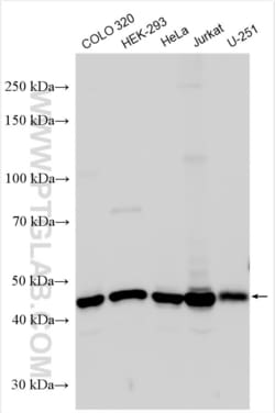 ARMC6 Rabbit, anti-Human, Polyclonal, Proteintech Quantity: 150 &mu;L:Antibodies