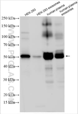 ARRDC1 Rabbit, anti-Human, Polyclonal, Proteintech:Antibodies:Primary Antibodies