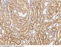 Sino Biological ART1 / CD296 / ARTC1 Antibody, Rabbit PAb, Antigen Affinity