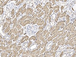 Sino Biological ASS1 Antibody, Rabbit PAb, Antigen Affinity Purified 100uL,