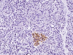 Sino Biological pro renin receptor/ATP6AP2 Antibody, Rabbit PAb, Antigen