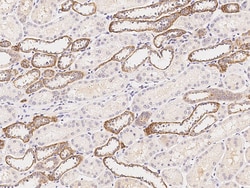 Sino Biological Anti-ATP6V0A4 Antibody, Rabbit Polyclonal, Quantity: Each