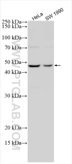 AURKA Rabbit, anti-Human, Polyclonal, Proteintech Quantity: 150 &mu;L:Antibodies